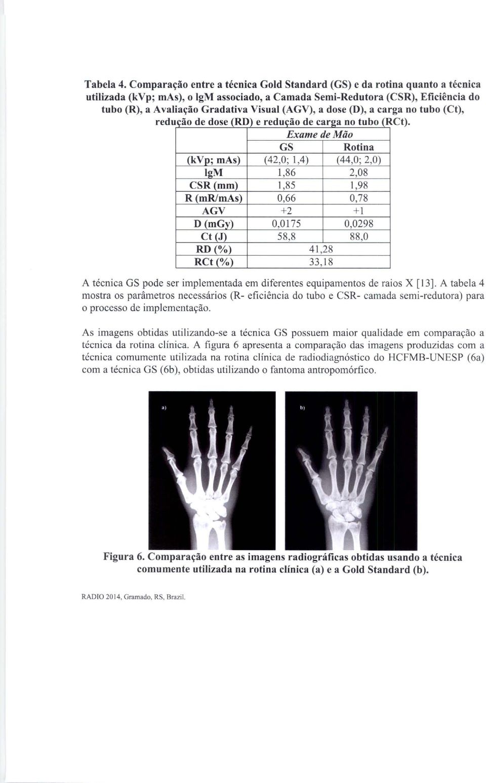 (AGV), a dose (D), a carga no tubo (Ct), redu lção de dose (RD) e redução de carga no tubo (R Ct).