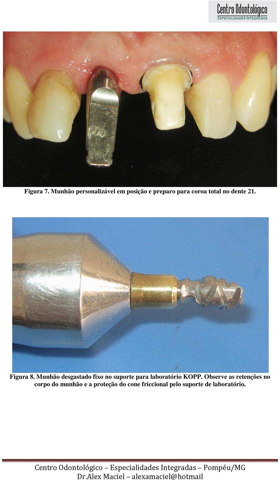 dente 21. Figura 8.