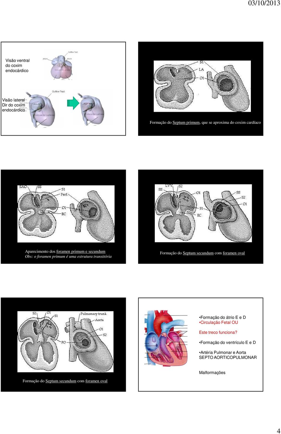 foramen primum é uma estrutura transitória Formação do Septum secundum com foramen oval Circulação