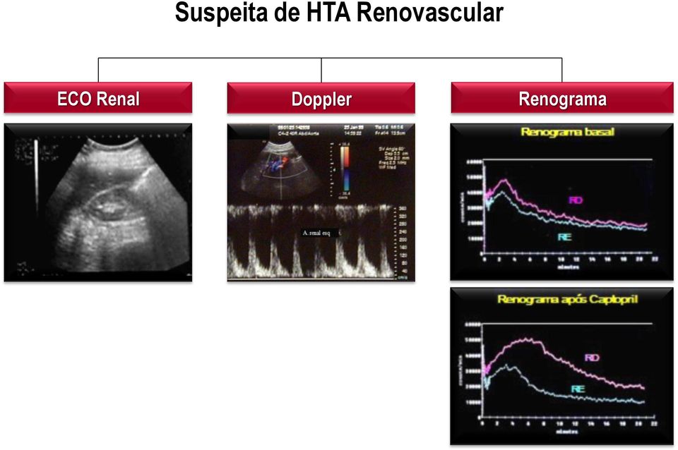 Renovascular