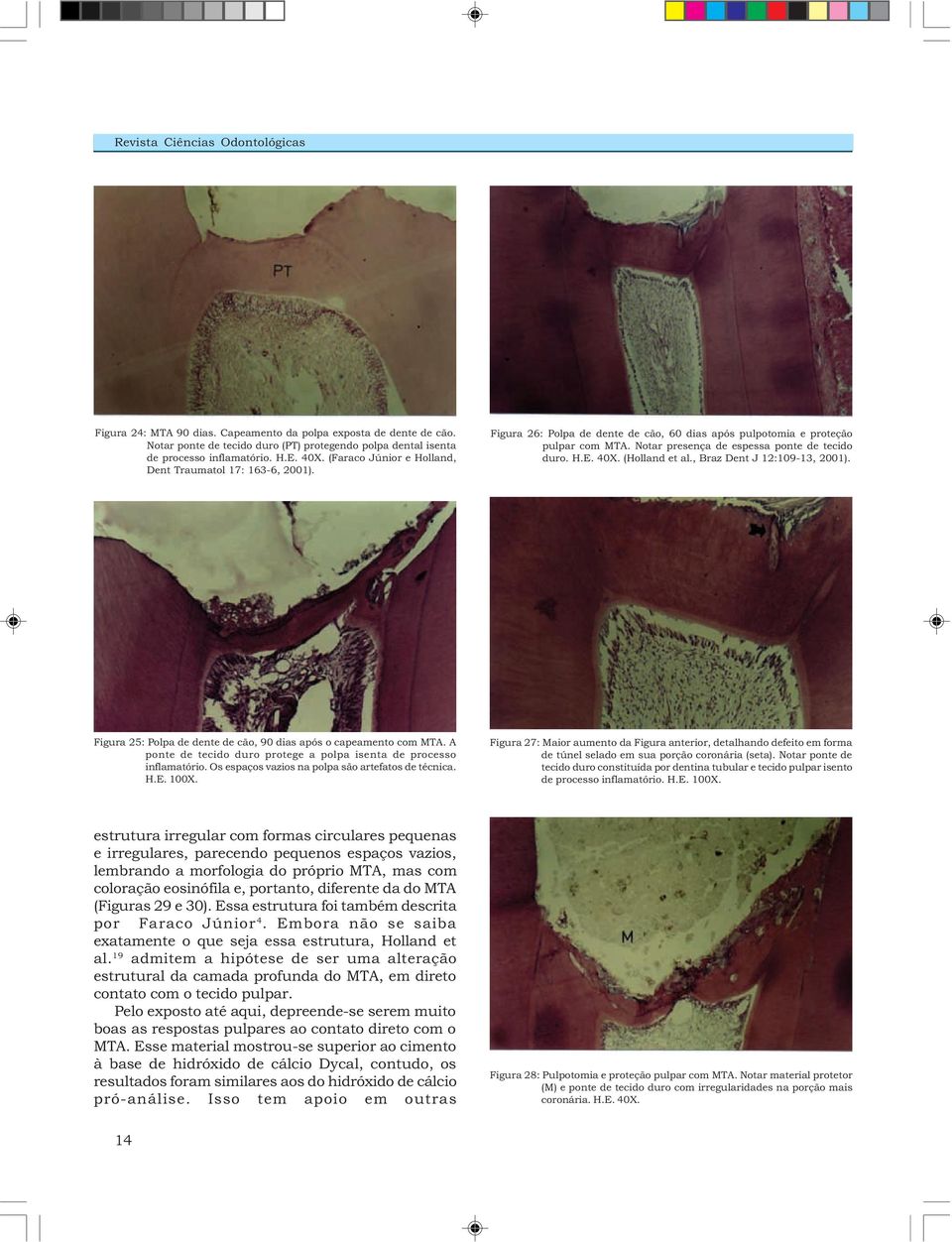 40X. (Holland et al., Braz Dent J 12:109-13, 2001). Figura 25: Polpa de dente de cão, 90 dias após o capeamento com MTA. A ponte de tecido duro protege a polpa isenta de processo inflamatório.