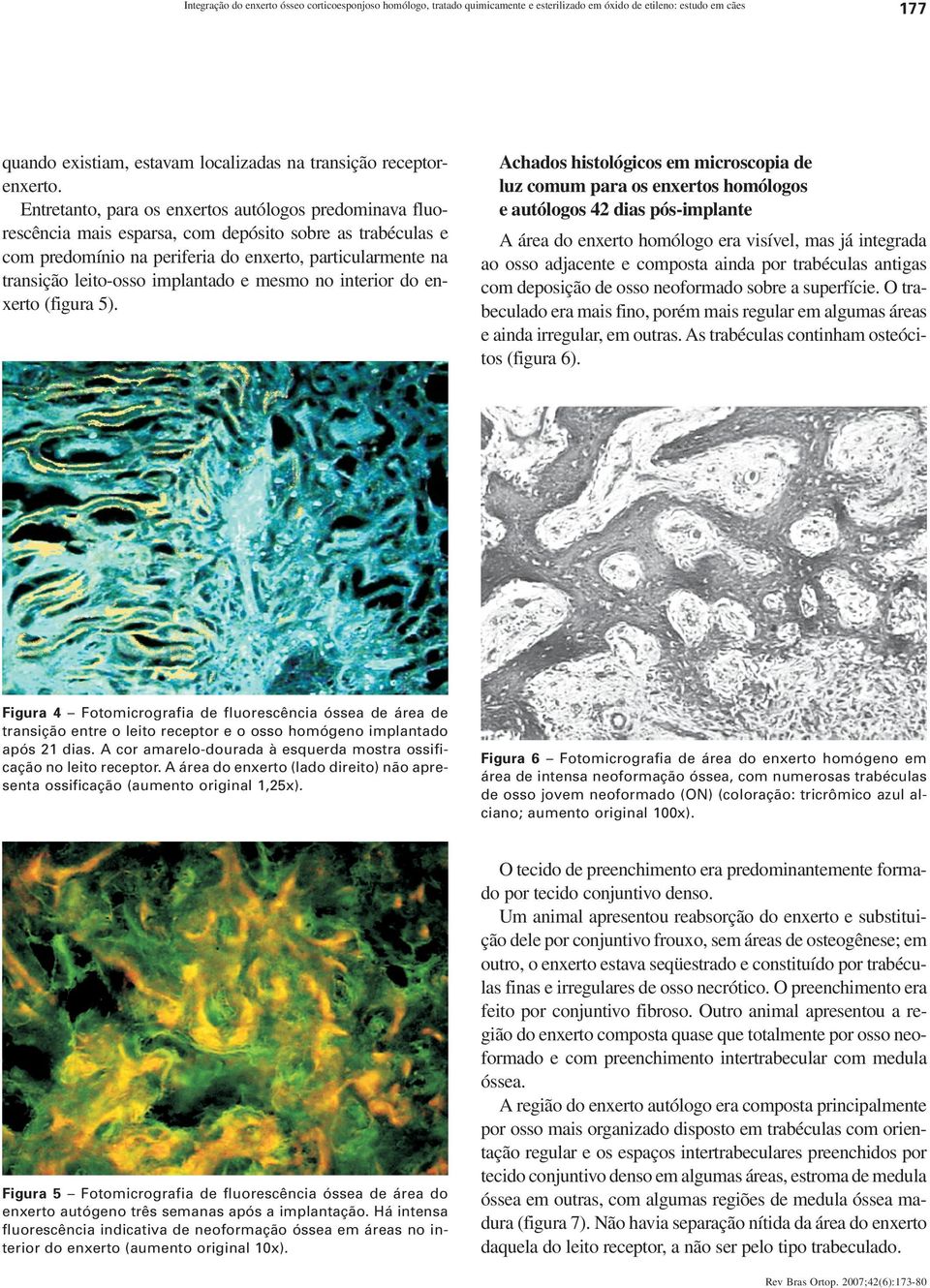 implantado e mesmo no interior do enxerto (figura 5). Figura 4 Fotomicrografia de fluorescência óssea de área de transição entre o leito receptor e o osso homógeno implantado após 21 dias.