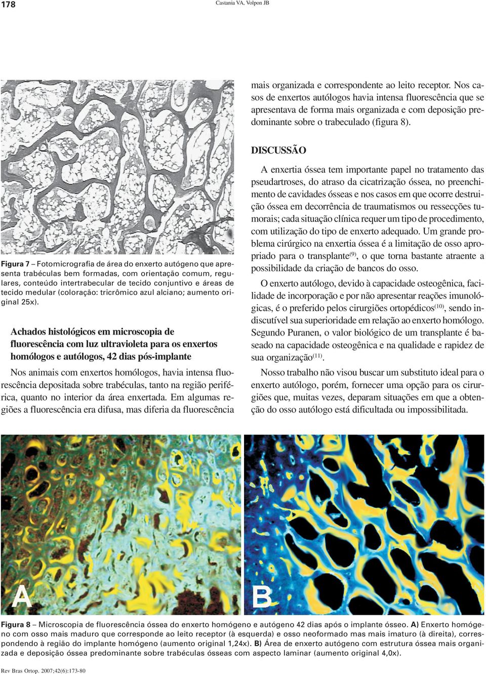 DISCUSSÃO Figura 7 Fotomicrografia de área do enxerto autógeno que apresenta trabéculas bem formadas, com orientação comum, regulares, conteúdo intertrabecular de tecido conjuntivo e áreas de tecido
