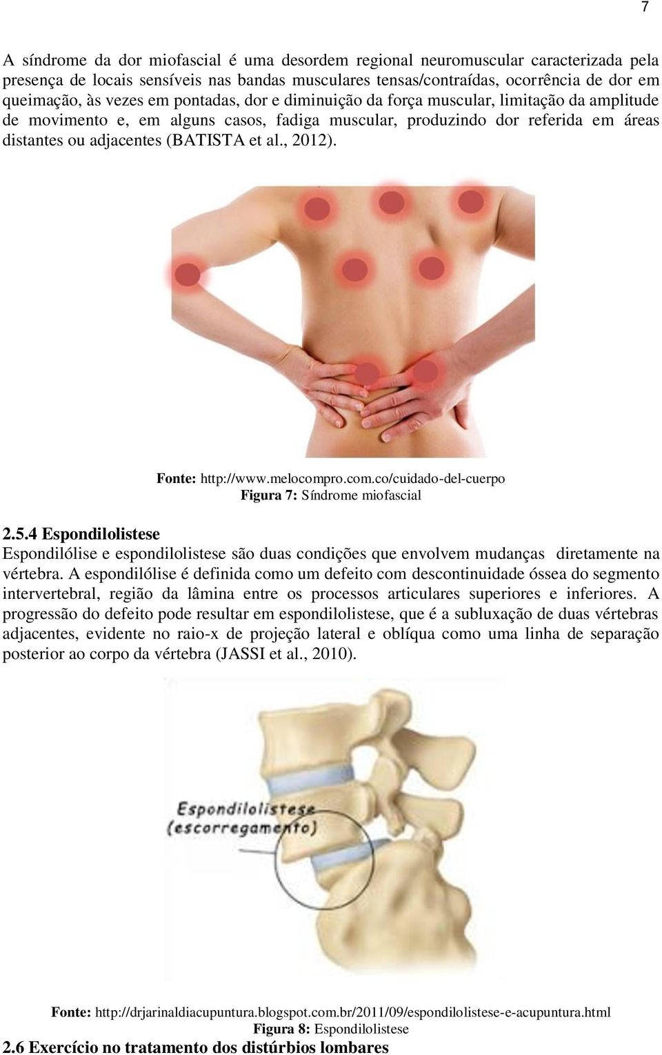 , 2012). Fonte: http://www.melocompro.com.co/cuidado-del-cuerpo Figura 7: Síndrome miofascial 2.5.