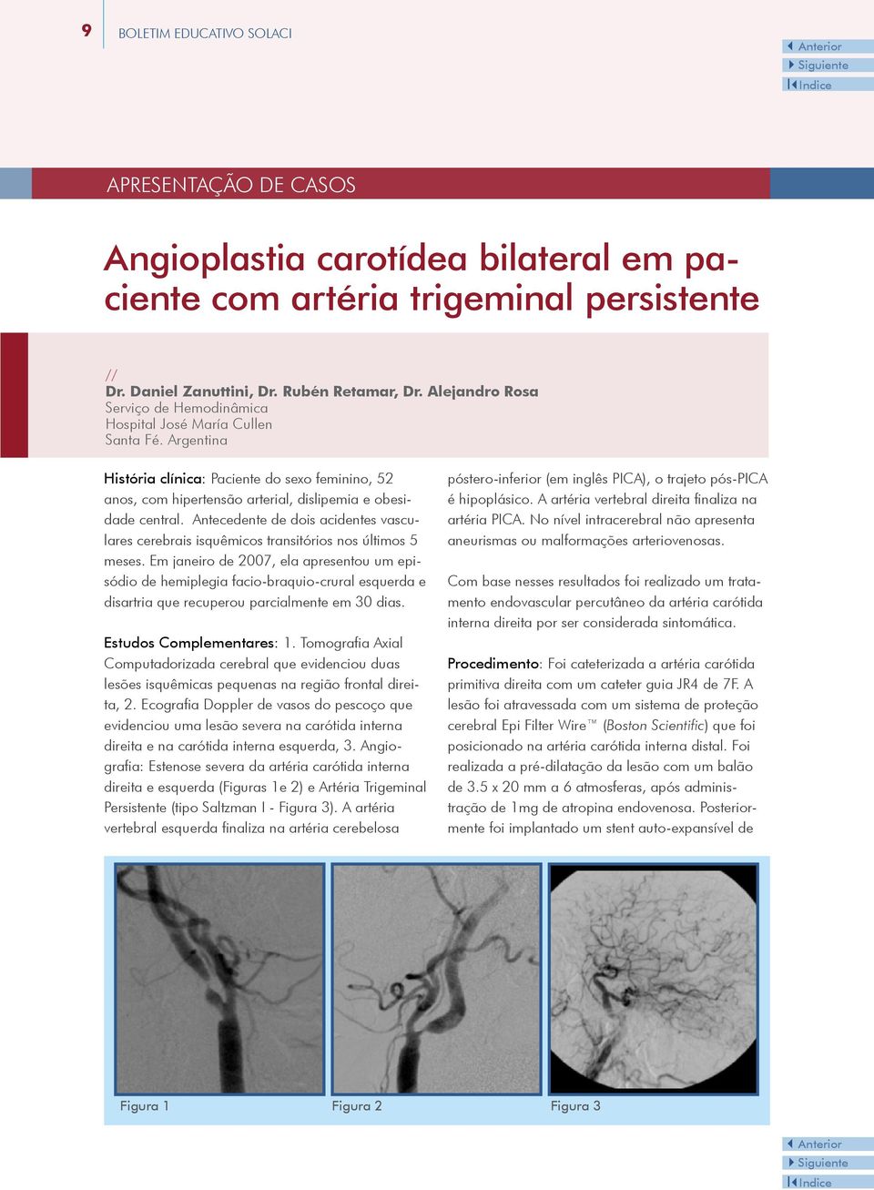 Antecedente de dois acidentes vasculares cerebrais isquêmicos transitórios nos últimos 5 meses.