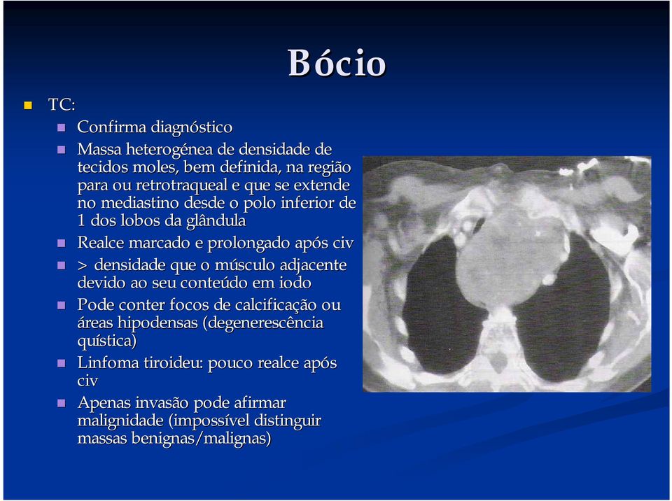 músculo m adjacente devido ao seu conteúdo em iodo Pode conter focos de calcificação ou áreas hipodensas (degenerescência quística)