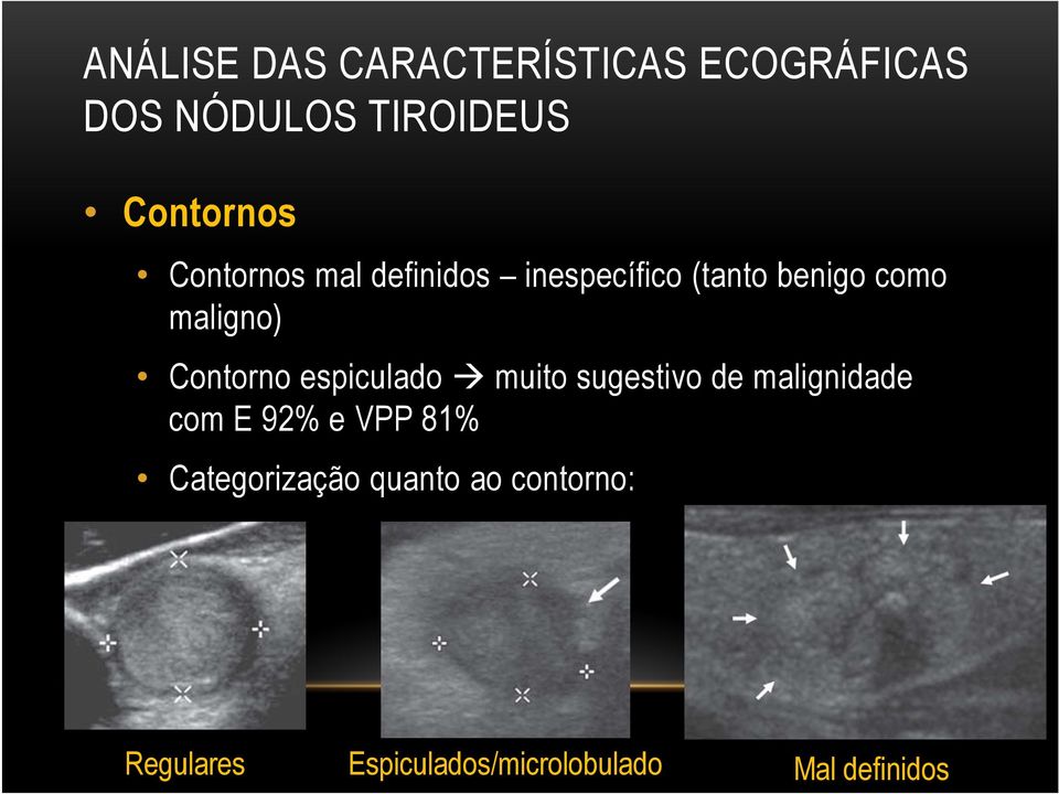 Contorno espiculado muito sugestivo de malignidade com E 92% e VPP 81%