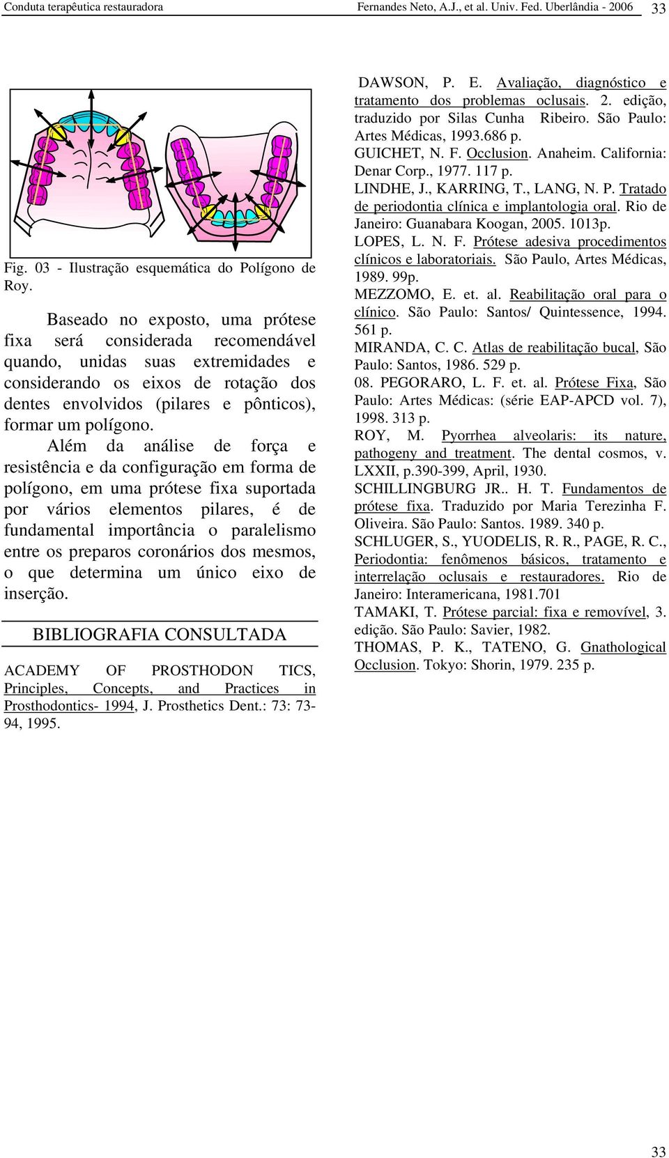 Além da análise de força e resistência e da configuração em forma de polígono, em uma prótese fixa suportada por vários elementos pilares, é de fundamental importância o paralelismo entre os preparos