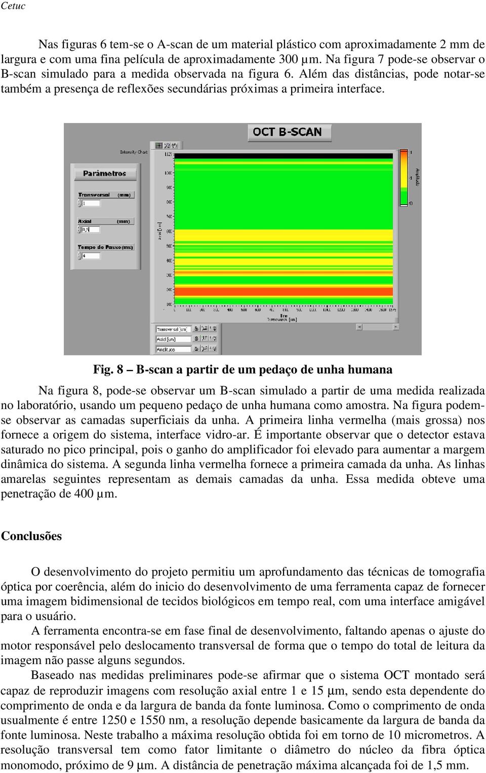 8 B-scan a partir de um pedaço de unha humana Na figura 8, pode-se observar um B-scan simulado a partir de uma medida realizada no laboratório, usando um pequeno pedaço de unha humana como amostra.