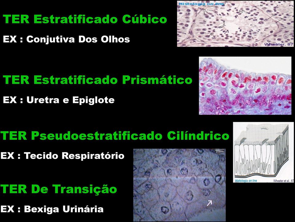 Epiglote TER Pseudoestratificado Cilíndrico EX :