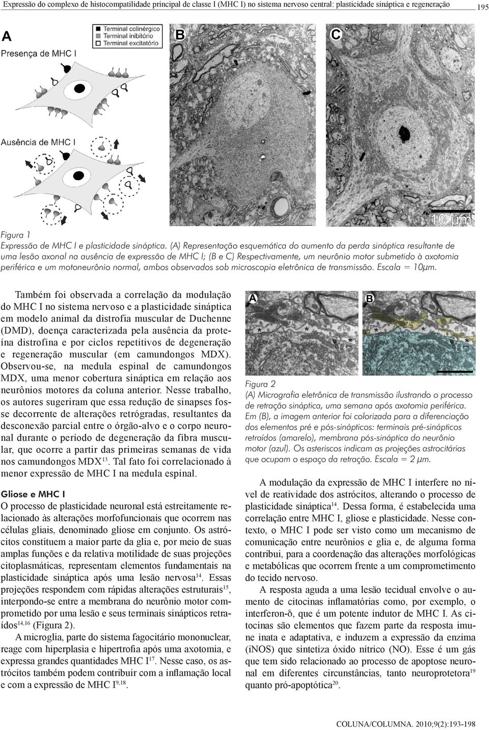 periférica e um motoneurônio normal, ambos observados sob microscopia eletrônica de transmissão. Escala = 10µm.