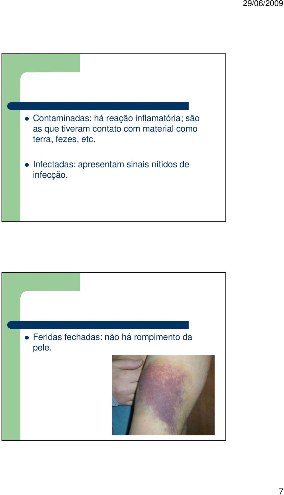 etc. Infectadas: apresentam sinais nítidos de