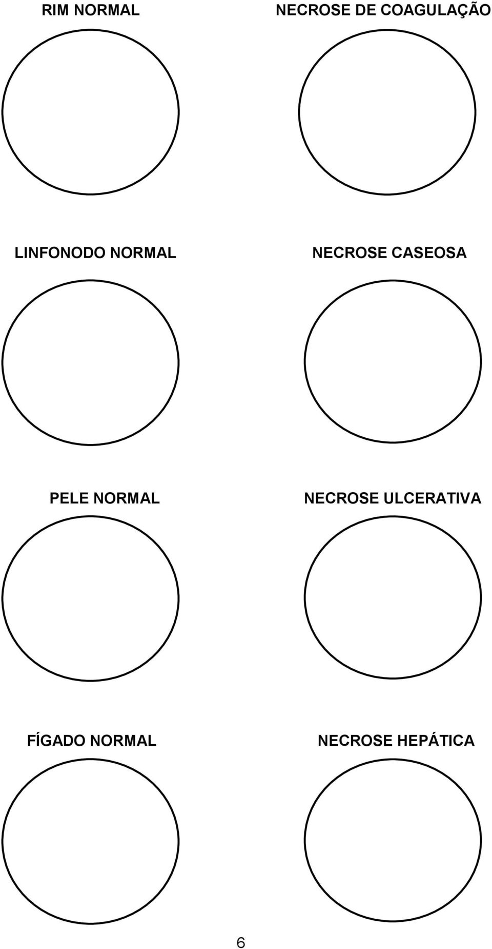 PELE NORMAL NECROSE ULCERATIVA