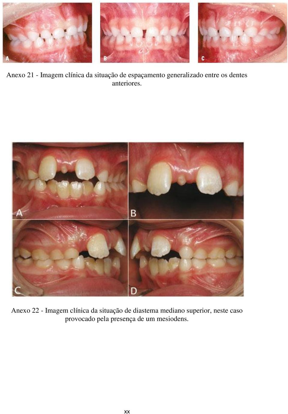 Anexo 22 - Imagem clínica da situação de diastema