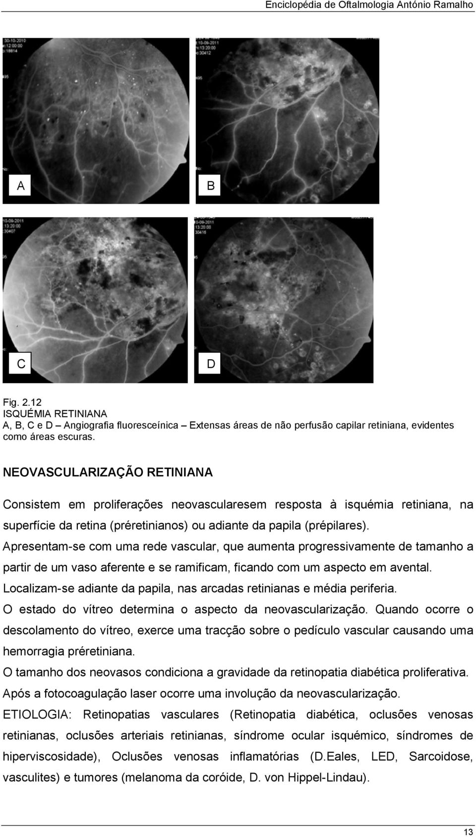 presentam-se com uma rede vascular, que aumenta progressivamente de tamanho a partir de um vaso aferente e se ramificam, ficando com um aspecto em avental.