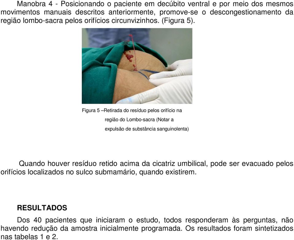 Figura 5 Retirada do resíduo pelos orifício na região do Lombo-sacra (Notar a expulsão de substância sanguinolenta) Quando houver resíduo retido acima da cicatriz