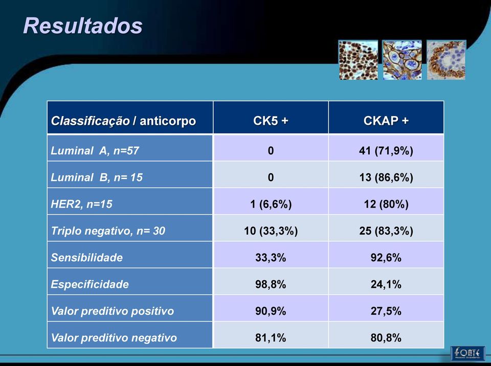 negativo, n= 30 10 (33,3%) 25 (83,3%) Sensibilidade 33,3% 92,6%