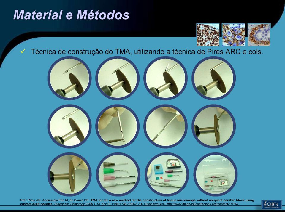 TMA for all: a new method for the construction of tissue microarrays without recipient