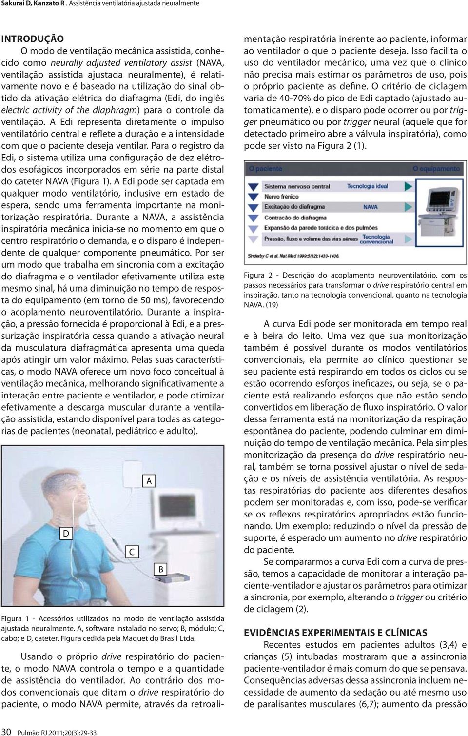 A Edi representa diretamente o impulso ventilatório central e reflete a duração e a intensidade com que o paciente deseja ventilar.