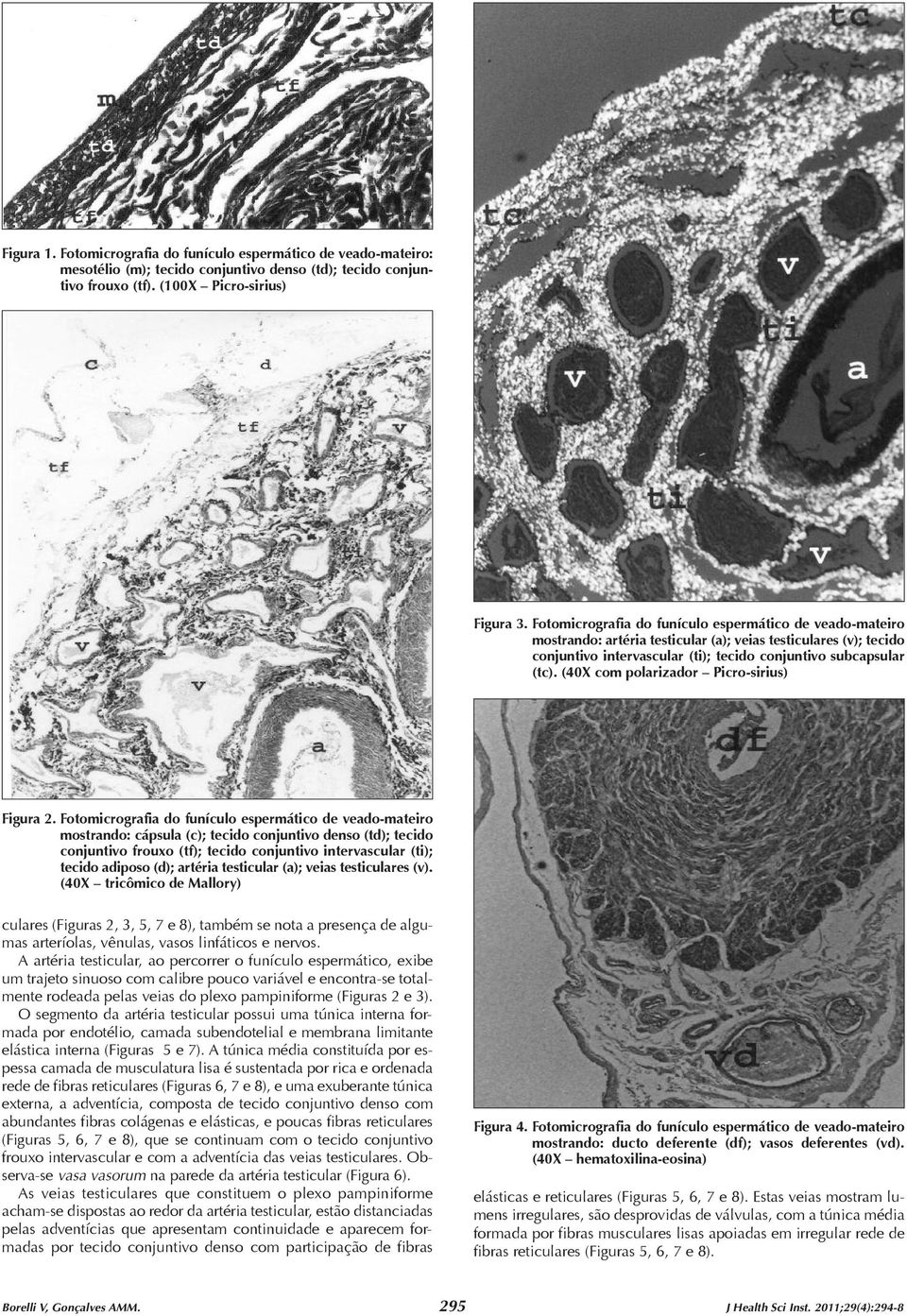 Fotomicrografia do funículo espermático de veado-mateiro mostrando: cápsula (c); tecido conjuntivo denso (td); tecido conjuntivo frouxo (tf); tecido conjuntivo intervascular (ti); tecido adiposo (d);