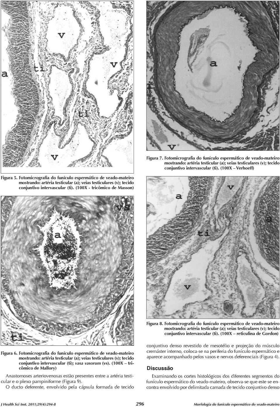 Fotomicrografia do funículo espermático de veado-mateiro conjuntivo intervascular (ti). (100X reticulina de Gordon) Figura 6.
