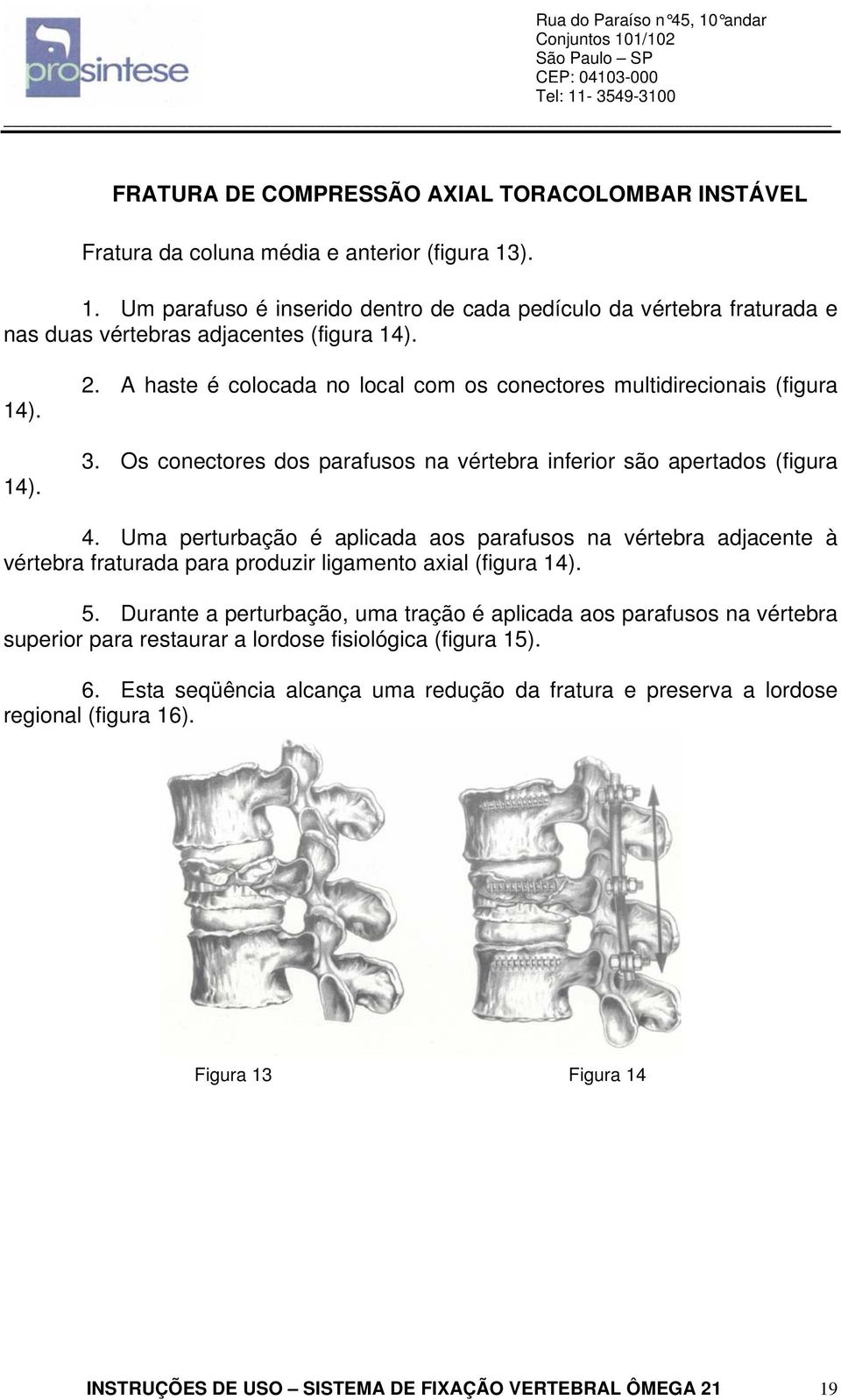 A haste é colocada no local com os conectores multidirecionais (figura 3. Os conectores dos parafusos na vértebra inferior são apertados (figura 4.