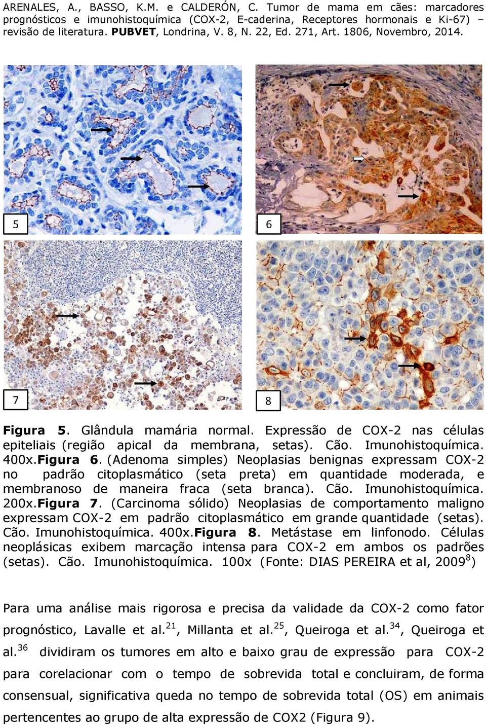 (Carcinoma sólido) Neoplasias de comportamento maligno expressam COX-2 em padrão citoplasmático em grande quantidade (setas). Cão. Imunohistoquímica. 400x.Figura 8. Metástase em linfonodo.