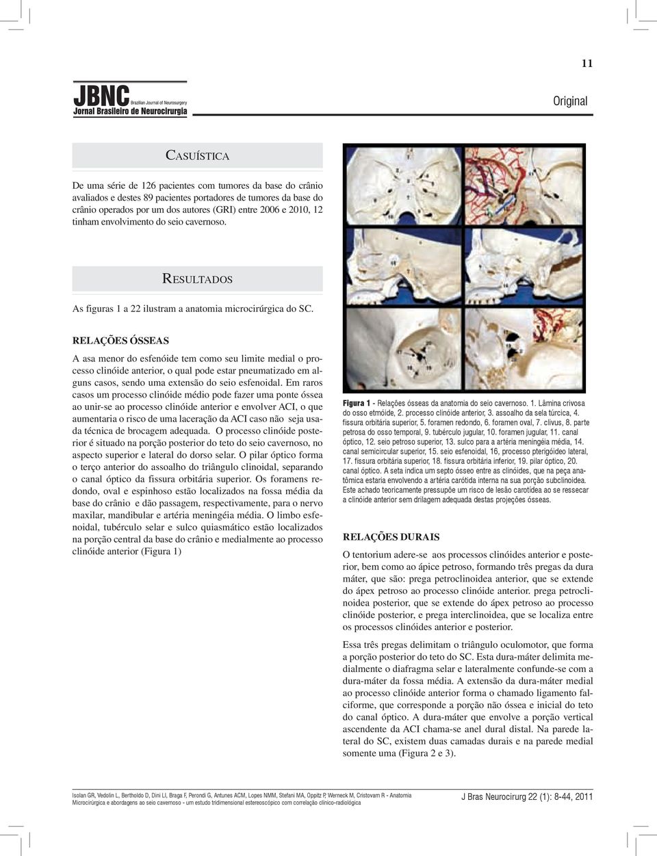 Relações ósseas A asa menor do esfenóide tem como seu limite medial o processo clinóide anterior, o qual pode estar pneumatizado em alguns casos, sendo uma extensão do seio esfenoidal.