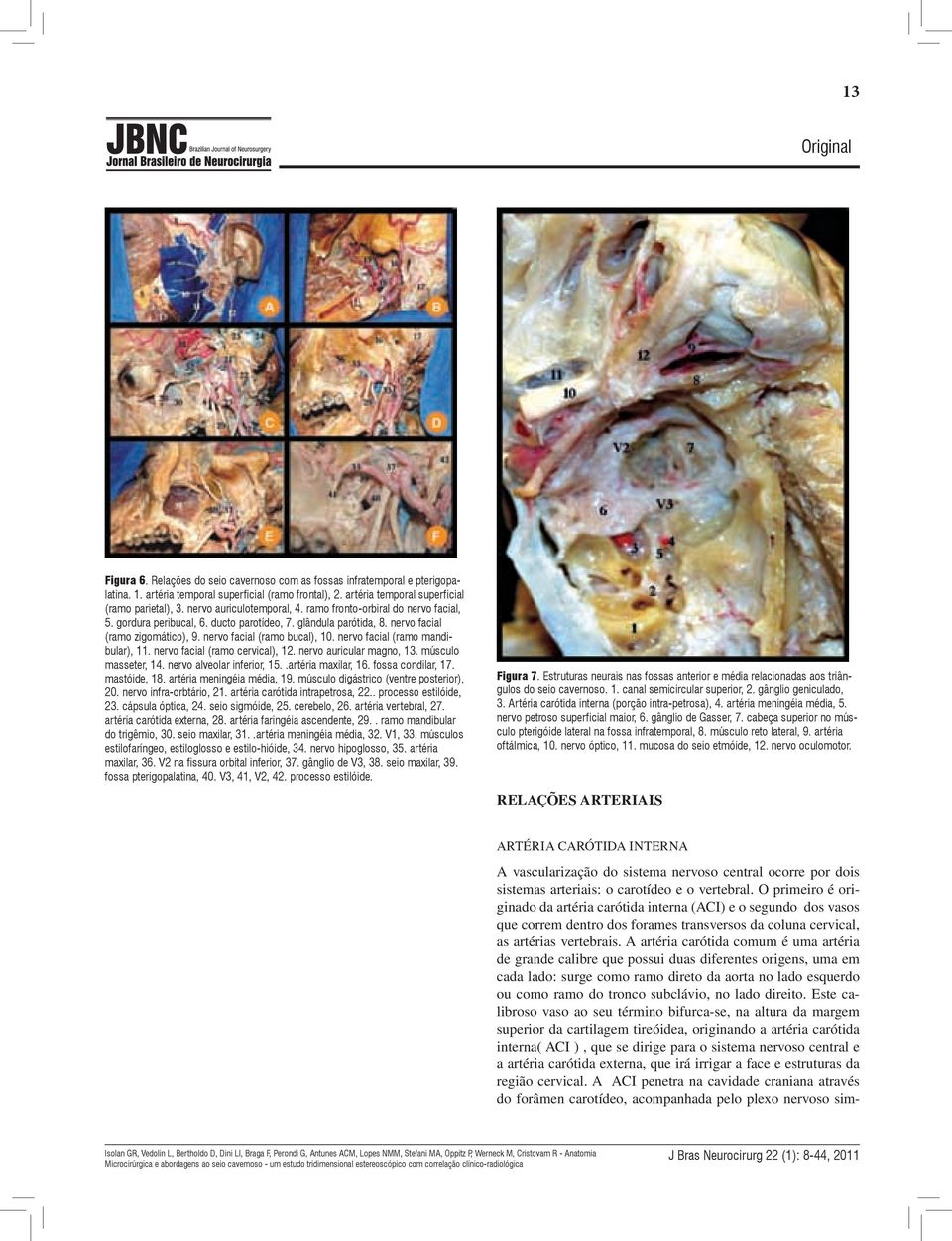 nervo facial (ramo mandibular), 11. nervo facial (ramo cervical), 12. nervo auricular magno, 13. músculo masseter, 14. nervo alveolar inferior, 15..artéria maxilar, 16. fossa condilar, 17.