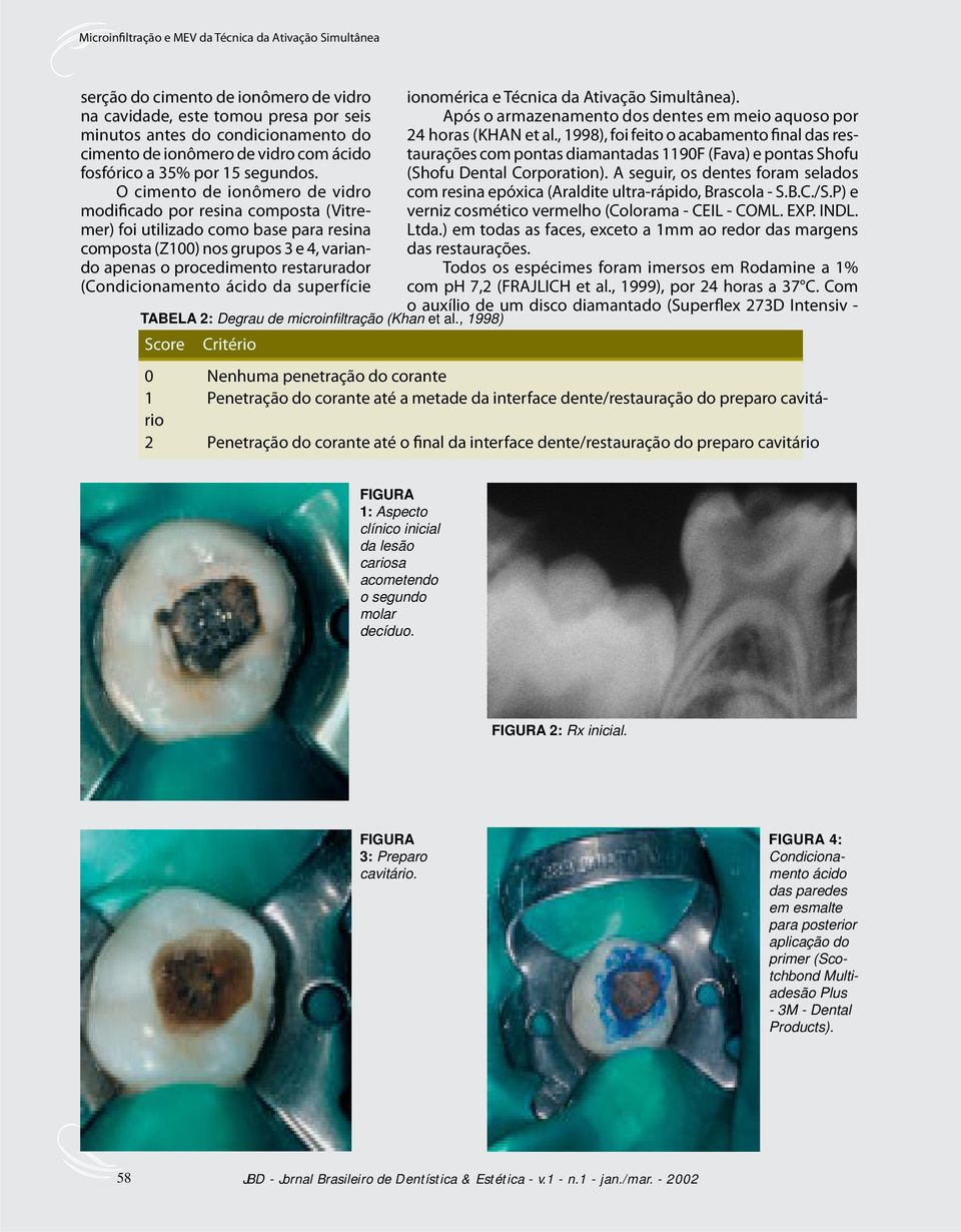 (Condicionamento ácido da superfície TABELA 2: Degrau de microinfi ltração (Khan et al., 1998) Score Critério ionomérica e Técnica da Ativação Simultânea).