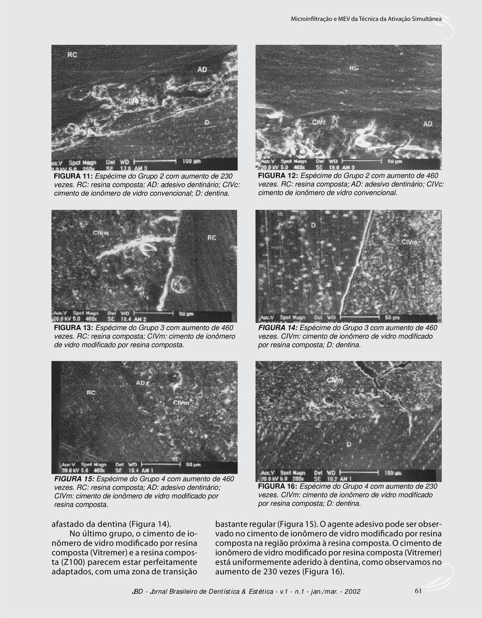 FIGURA 13: Espécime do Grupo 3 com aumento de 460 vezes. RC: resina composta; CIVm: cimento de ionômero de vidro modifi cado por resina composta.
