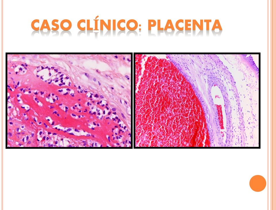 PLACENTA