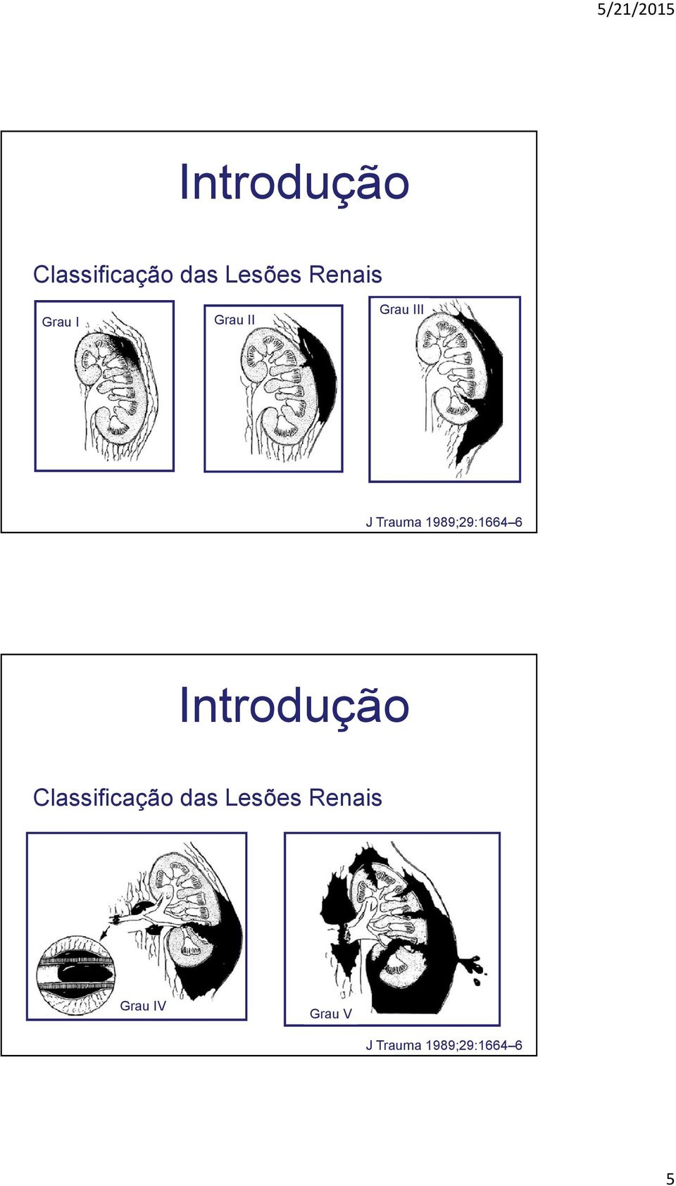 1989;29:1664 6  Grau IV Grau V J Trauma