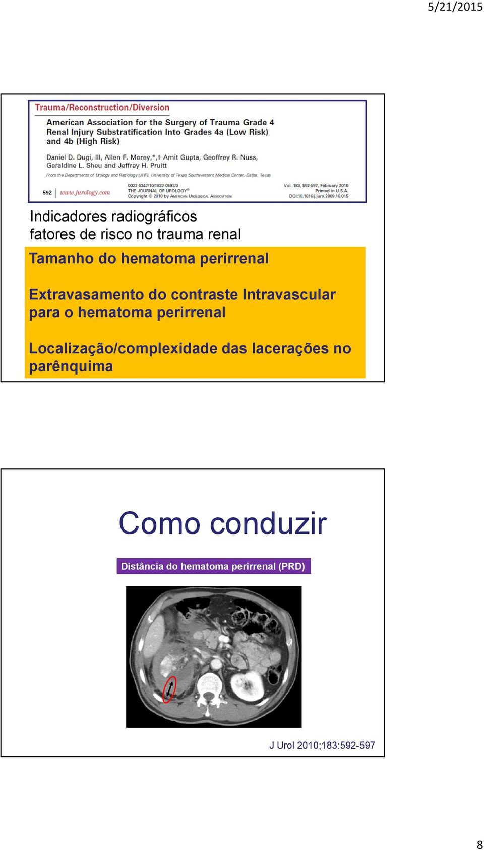 hematoma perirrenal Localização/complexidadedas laceraçõesno parênquima