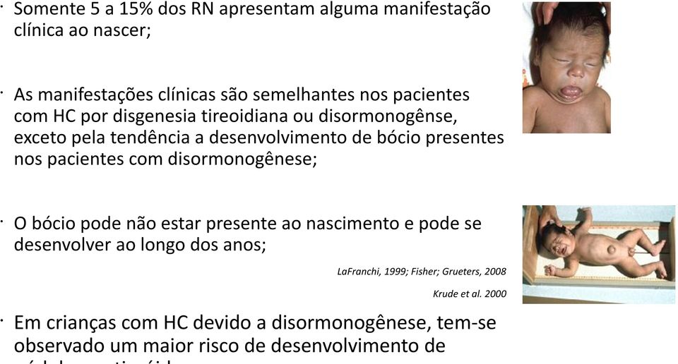 disormonogênese; O bócio pode não estar presente ao nascimento e pode se desenvolver ao longo dos anos; LaFranchi, 1999; Fisher;