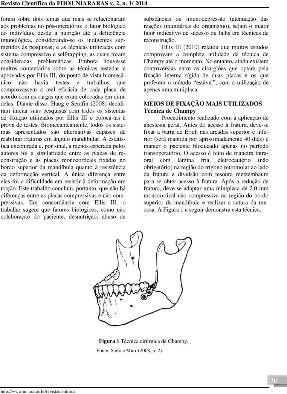 Embora houvesse muitos comentários sobre as técnicas testadas e aprovadas por Ellis III, do ponto de vista biomecânico não havia testes e trabalhos que comprovassem a real eficácia de cada placa de