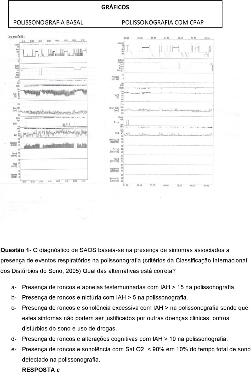 b- Presença de roncos e nictúria com IAH > 5 na polissonografia.