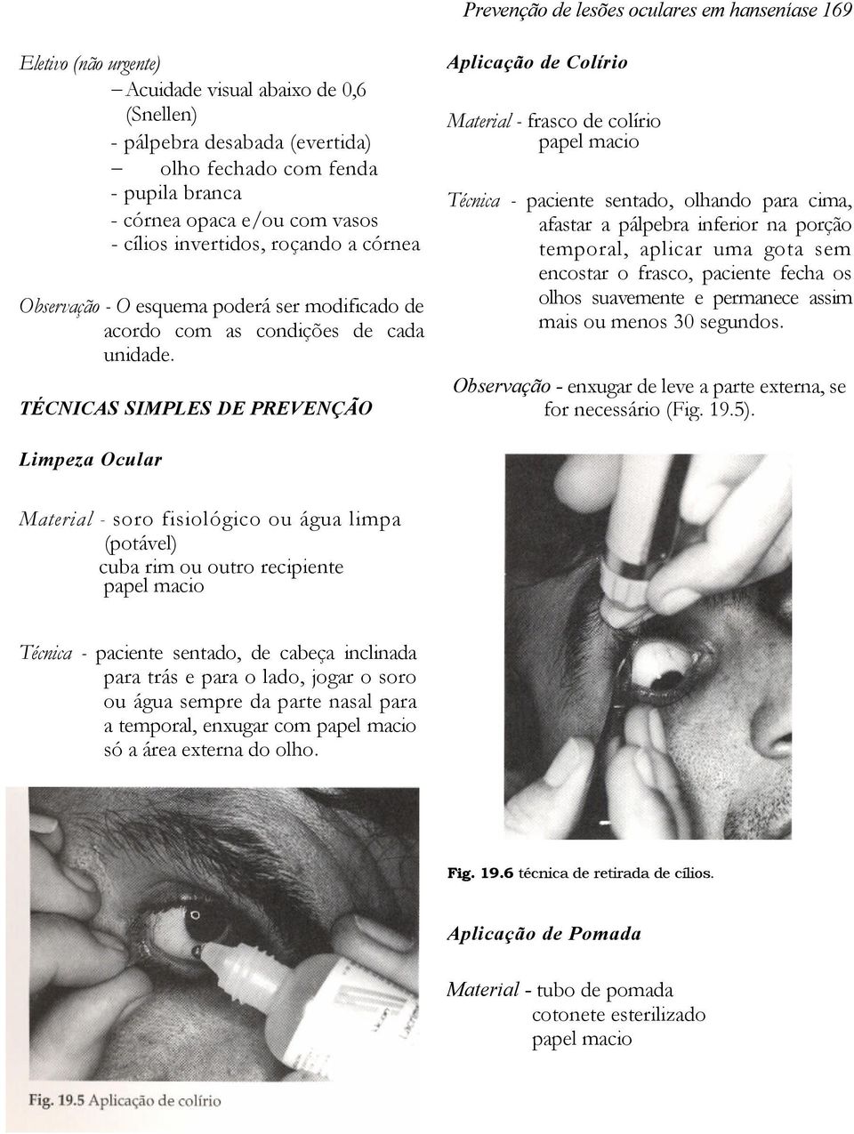 TÉCNICAS SIMPLES DE PREVENÇÃO Aplicação de Colírio Material - frasco de colírio papel macio Técnica - paciente sentado, olhando para cima, afastar a pálpebra inferior na porção temporal, aplicar uma