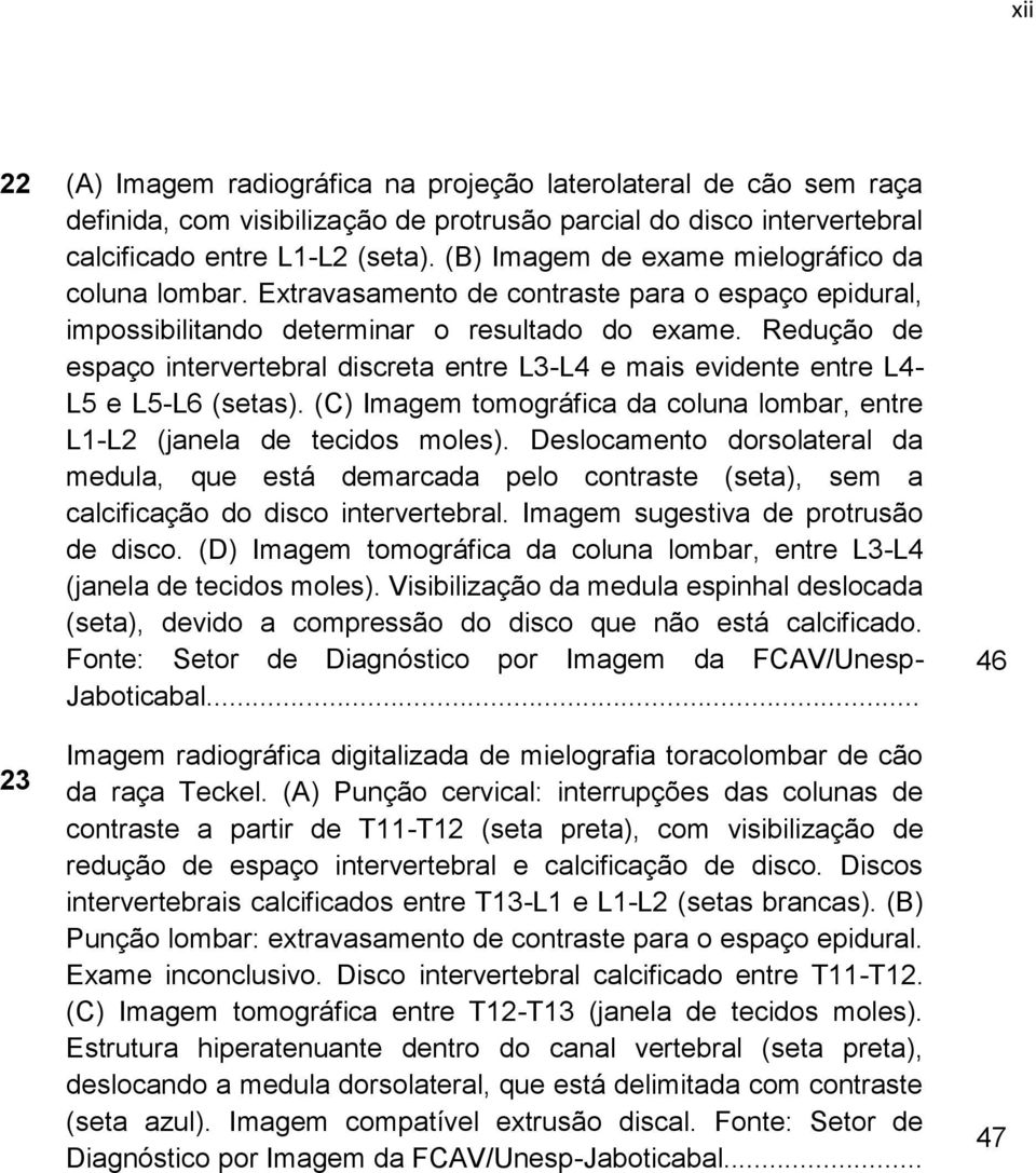 Redução de espaço intervertebral discreta entre L3-L4 e mais evidente entre L4- L5 e L5-L6 (setas). (C) Imagem tomográfica da coluna lombar, entre L1-L2 (janela de tecidos moles).