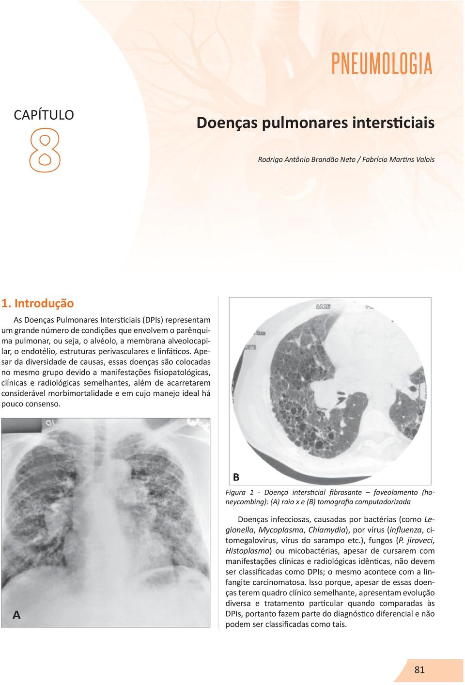 estruturas perivasculares e linfáticos.