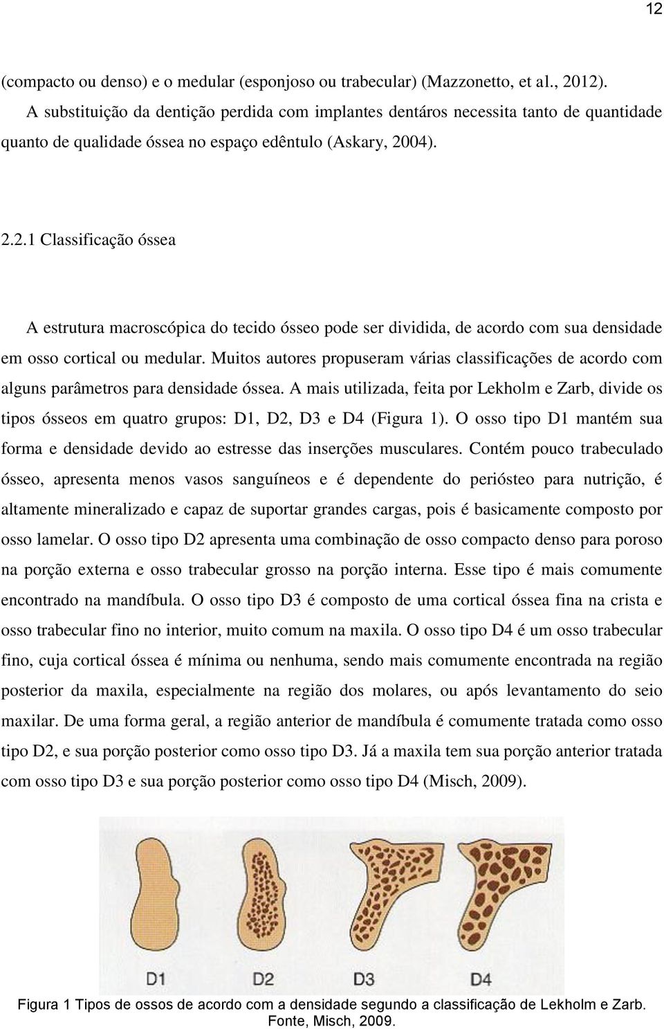 04). 2.2.1 Classificação óssea A estrutura macroscópica do tecido ósseo pode ser dividida, de acordo com sua densidade em osso cortical ou medular.