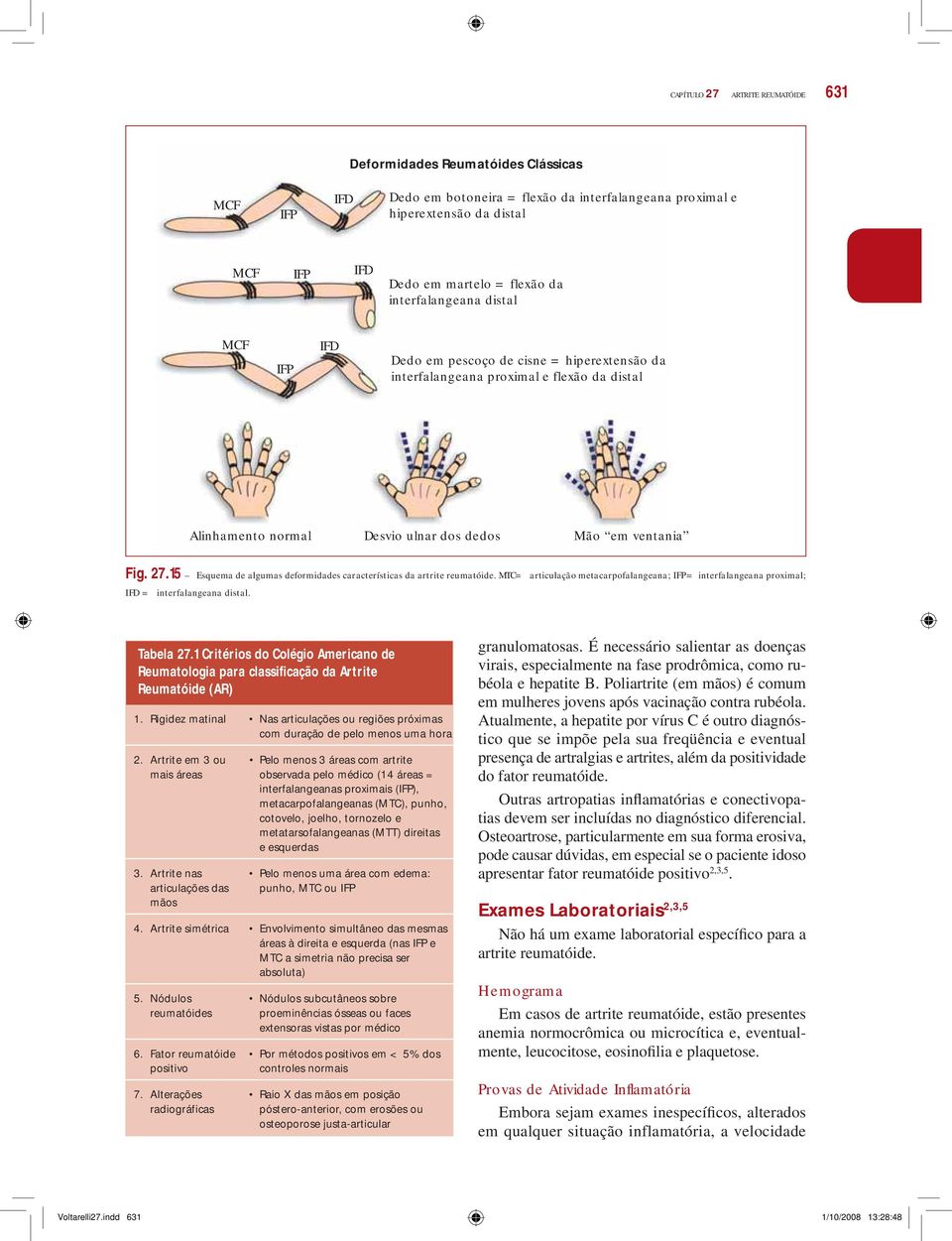 15 Esquema de algumas deformidades características da artrite reumatóide. MTC= articulação metacarpofalangeana; IFP=interfalangeana proximal; IFD = interfalangeana distal. Tabela 27.