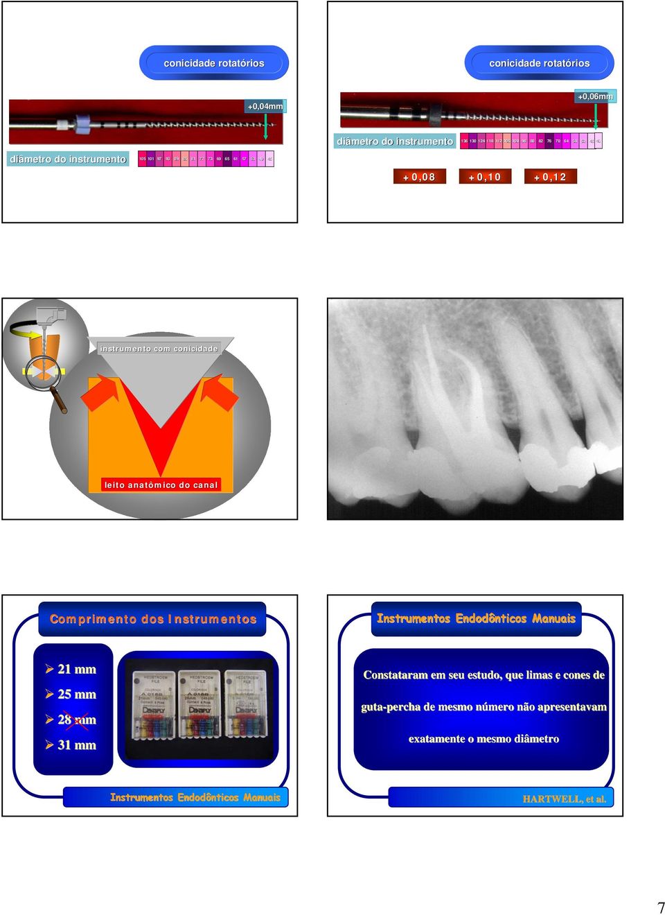 instrumento com conicidade leito anatômico do canal Comprimento dos Instrumentos 21 mm 25 mm 28 mm 31 mm Constataram em