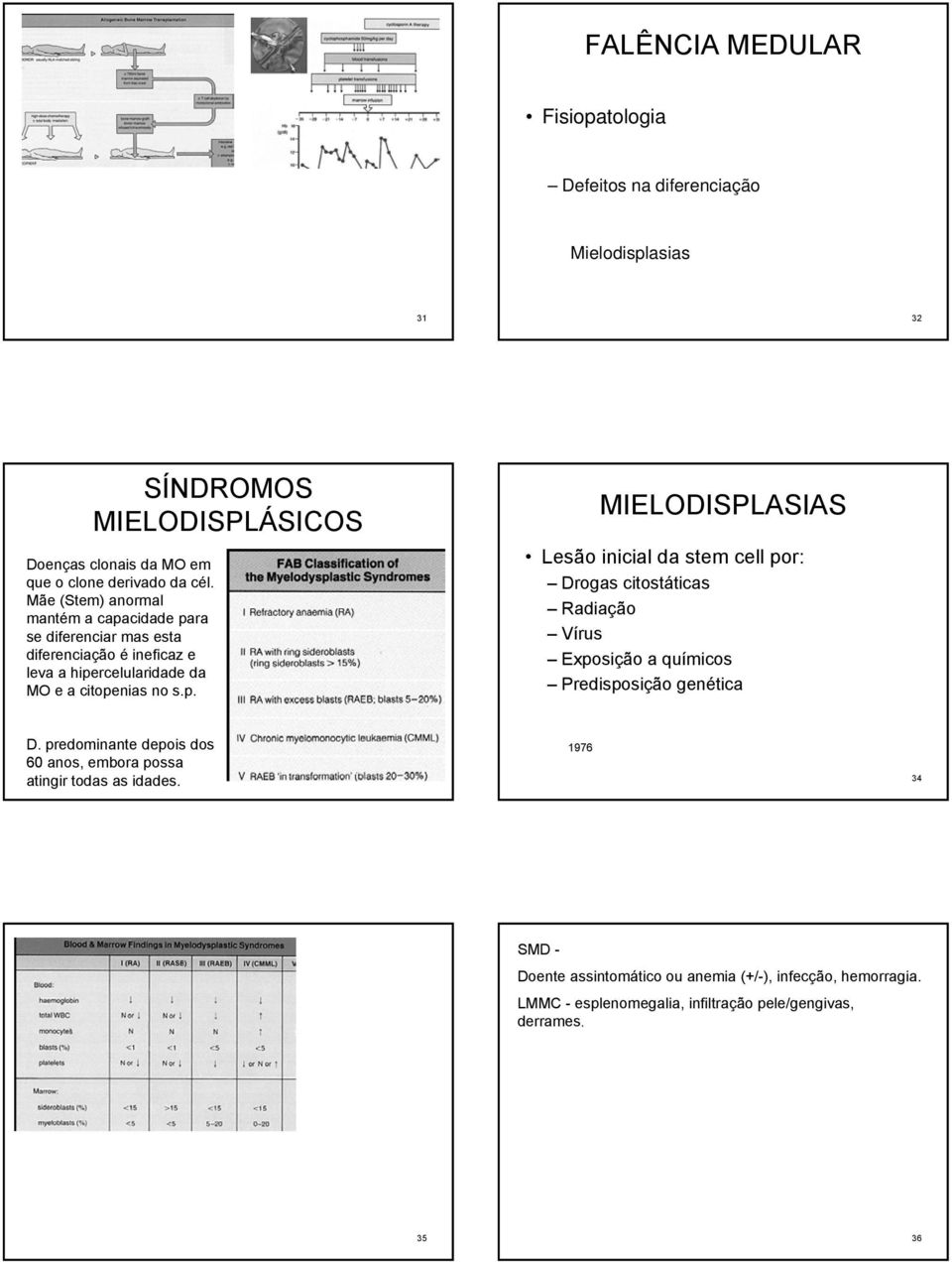 cidade para se diferenciar mas esta diferenciação é ineficaz e leva a hipercelularidade da MO e a citopenias no s.p. MIELODISPLASIAS Lesão inicial da stem cell por: Drogas citostáticas Radiação Vírus Exposição a químicos Predisposição genética D.