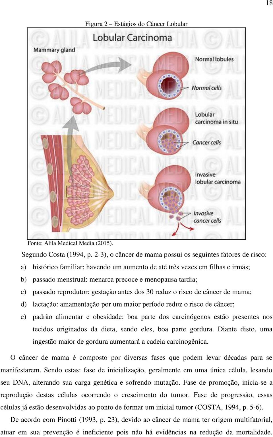 c) passado reprodutor: gestação antes dos 30 reduz o risco de câncer de mama; d) lactação: amamentação por um maior período reduz o risco de câncer; e) padrão alimentar e obesidade: boa parte dos