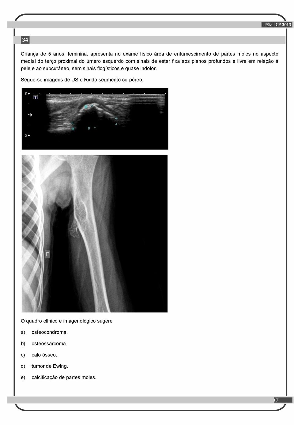 subcutâneo, sem sinais flogísticos e quase indolor. Segue-se imagens de US e Rx do segmento corpóreo.