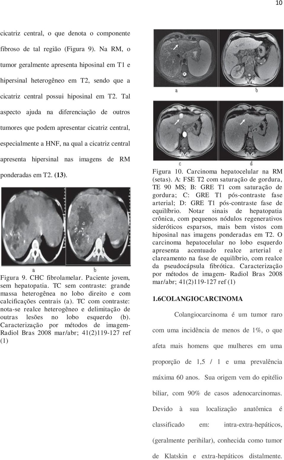 Tal aspecto ajuda na diferenciação de outros tumores que podem apresentar cicatriz central, especialmente a HNF, na qual a cicatriz central apresenta hipersinal nas imagens de RM ponderadas em T2.