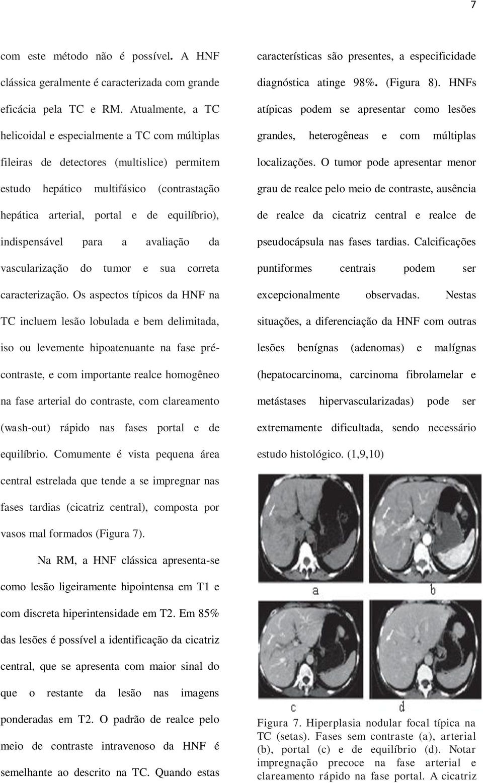 indispensável para a avaliação da vascularização do tumor e sua correta caracterização.