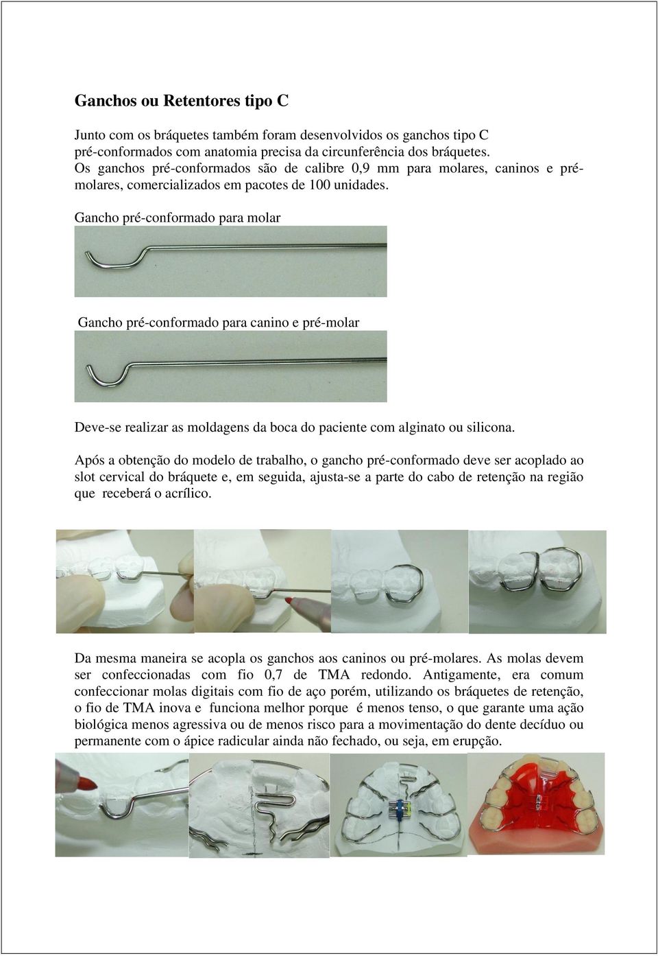 Gancho pré-conformado para molar Gancho pré-conformado para canino e pré-molar Deve-se realizar as moldagens da boca do paciente com alginato ou silicona.