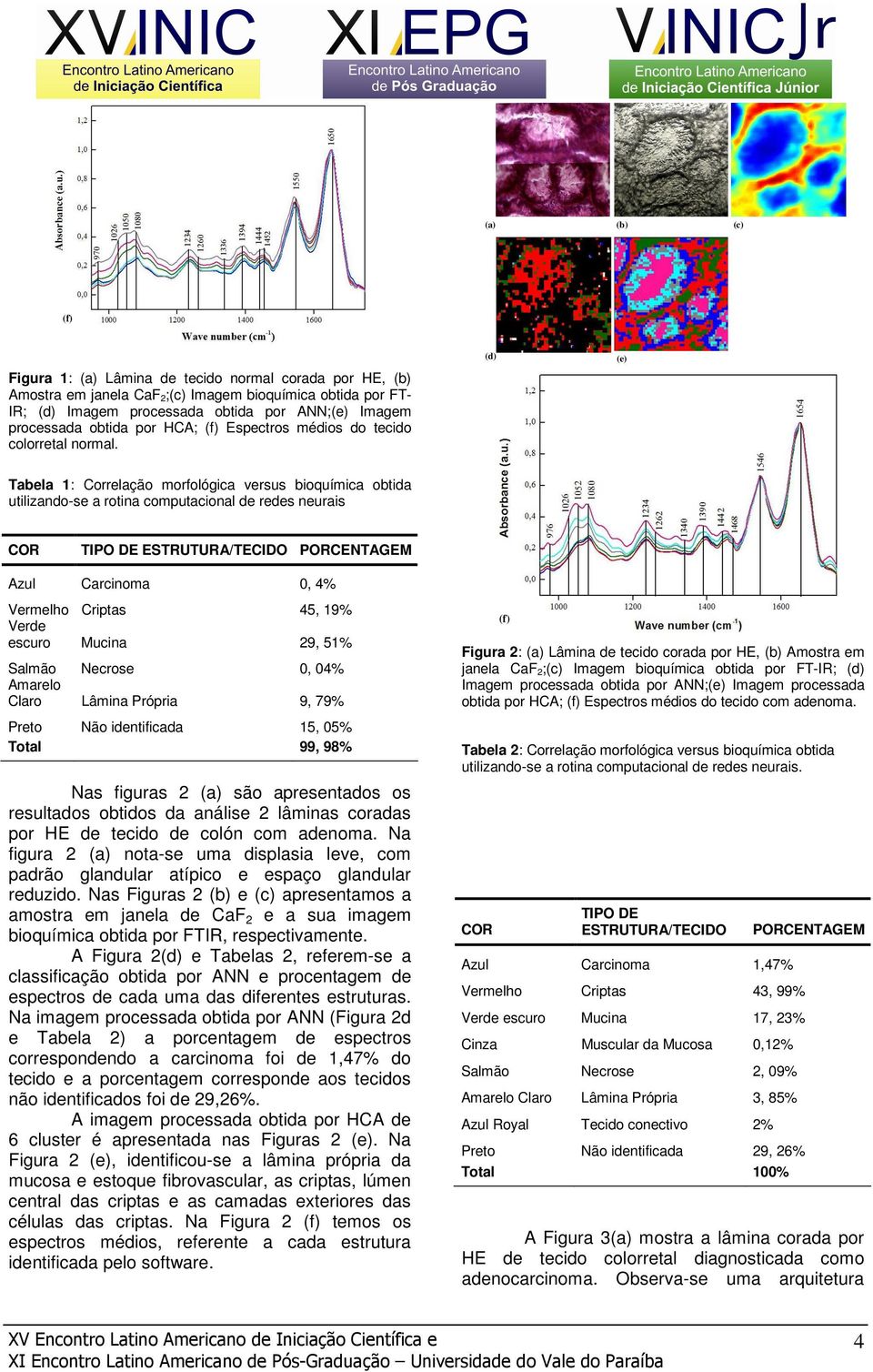(d) (e) Tabela 1: Correlação morfológica versus bioquímica obtida utilizando-se a rotina computacional de redes neurais COR TIPO DE ESTRUTURA/TECIDO PORCENTAGEM Azul Carcinoma 0, 4% Vermelho Criptas